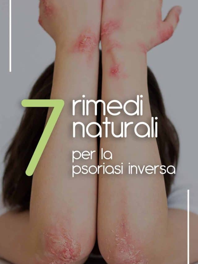 7-rimedi-naturali-per-la-psoriasi-inversa-1