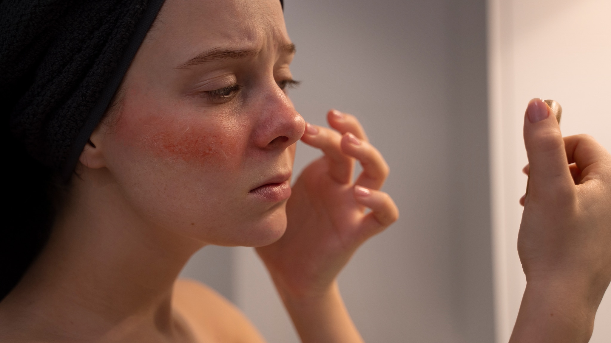 psoriasi viso rimedi naturali