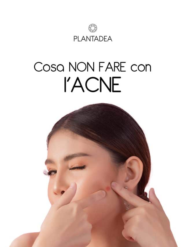 cosa-non-fare-con-l'acne-1