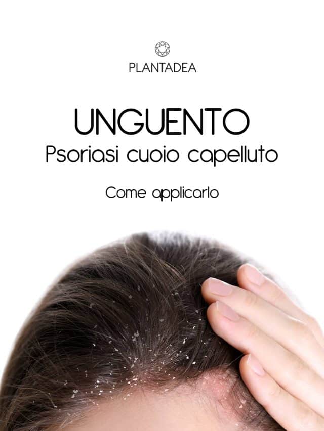 Unguento-psoriasi-capelluto-copertina