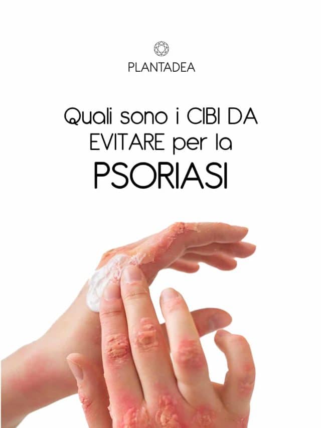 cibi da evitare psoriasi