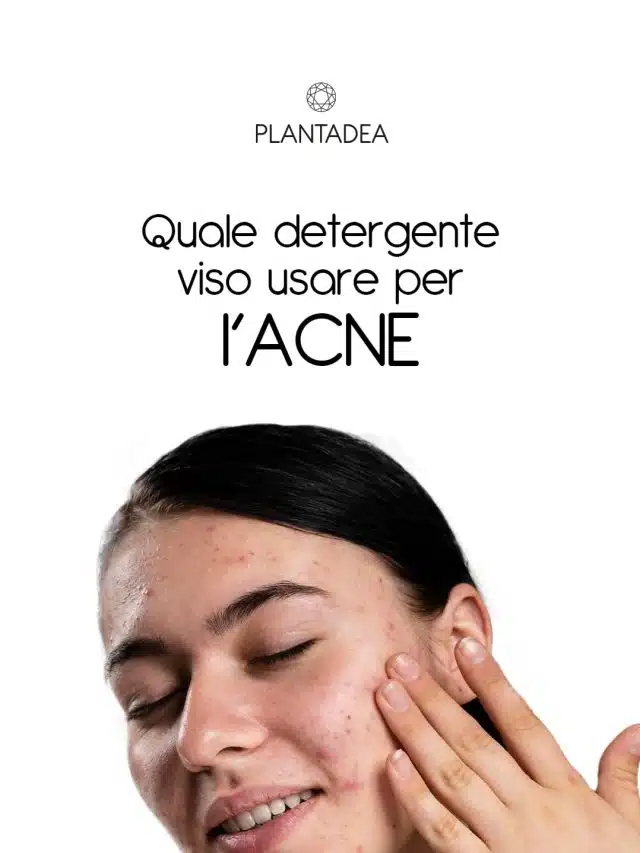 quale-detergente-viso-usare-per-acne-copertina