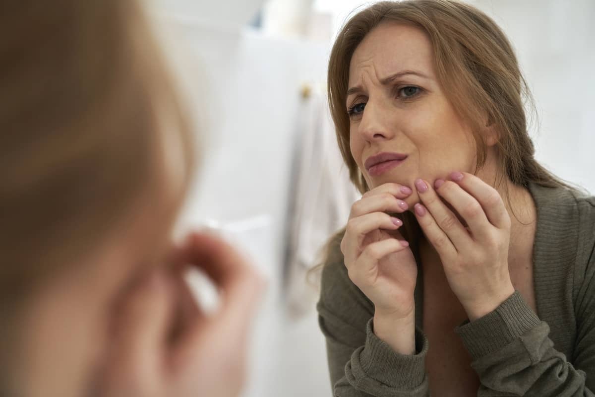 Donna di mezza età con acne tardiva