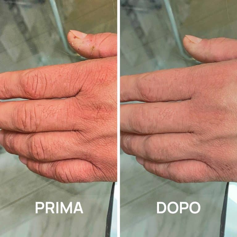 Crema mani foto prima e dopo PlantaDea