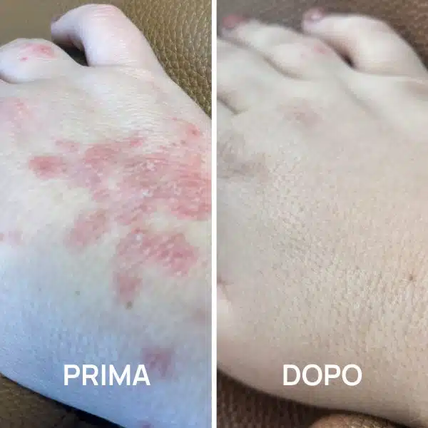 Crema mani foto prima e dopo PlantaDea