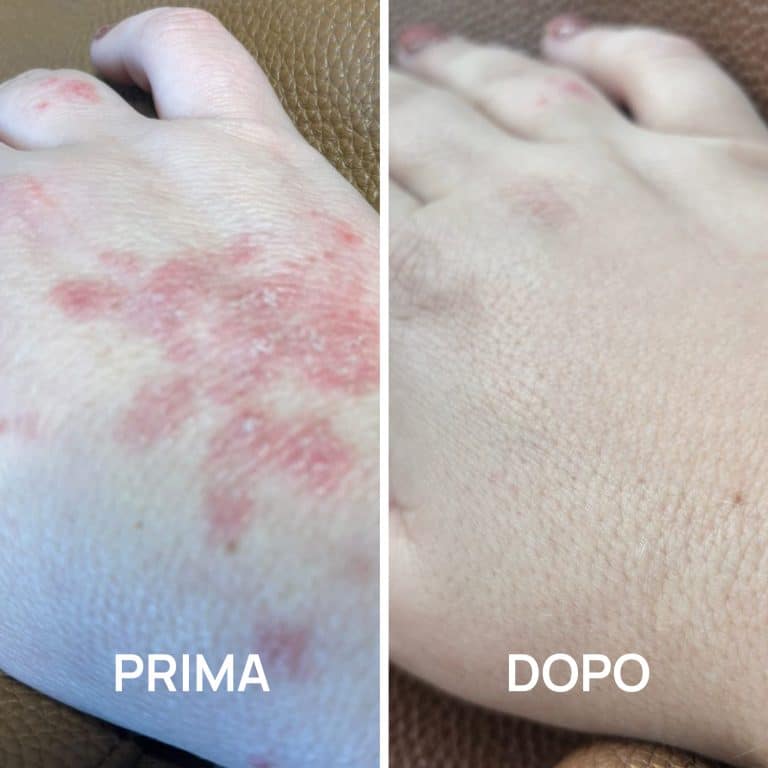 Crema mani foto prima e dopo PlantaDea
