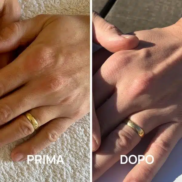 Crema mani foto prima e dopo PlantaDea