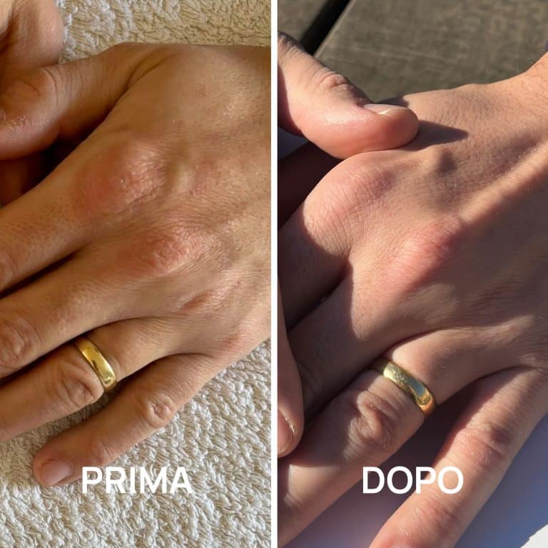Crema mani foto prima e dopo PlantaDea