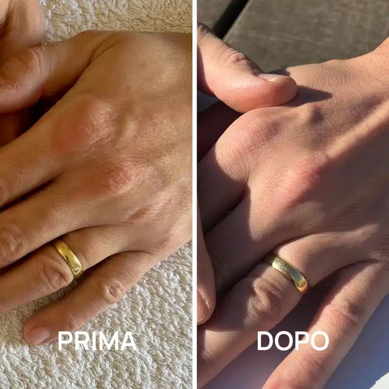 Crema mani foto prima e dopo PlantaDea