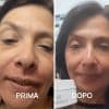 dermatite atopica foto prima e dopo PlantaDea