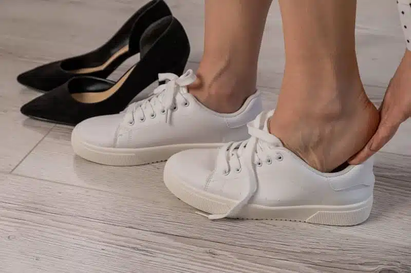 indossare scarpe adatte per prevenire la pelle screpolata dei piedi
