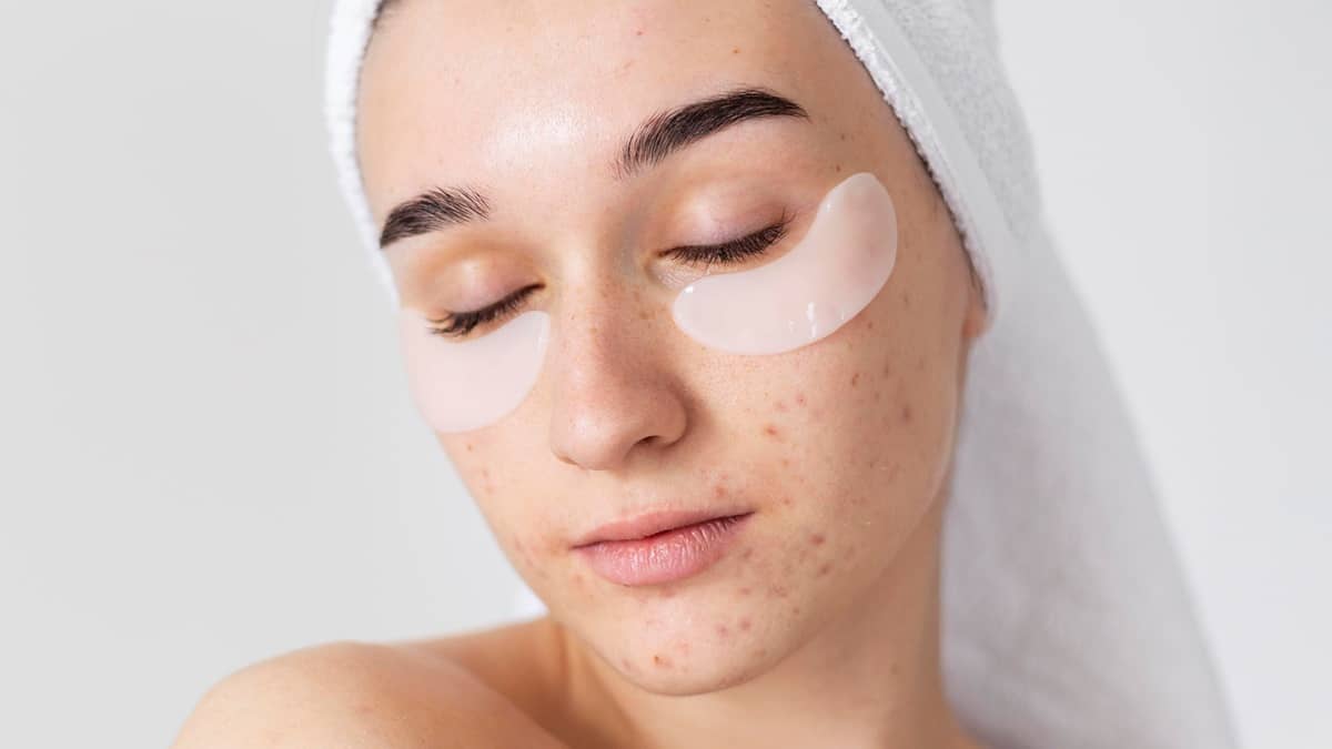 Skincare pelle grassa