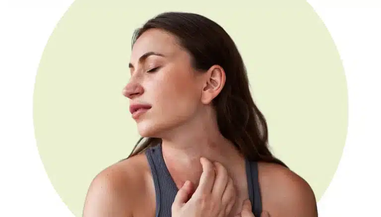 come ho sconfitto la dermatite atopica con il CBD